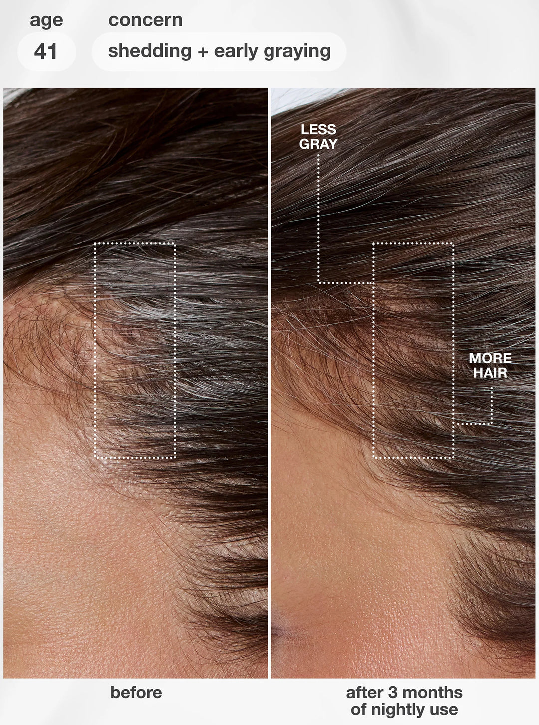 K18 FutureIQ Biomimetic Hair Longevity Serum | Reduce Shedding, Graying + Scalp Aging