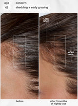 K18 FutureIQ Biomimetic Hair Longevity Serum | Reduce Shedding, Graying + Scalp Aging