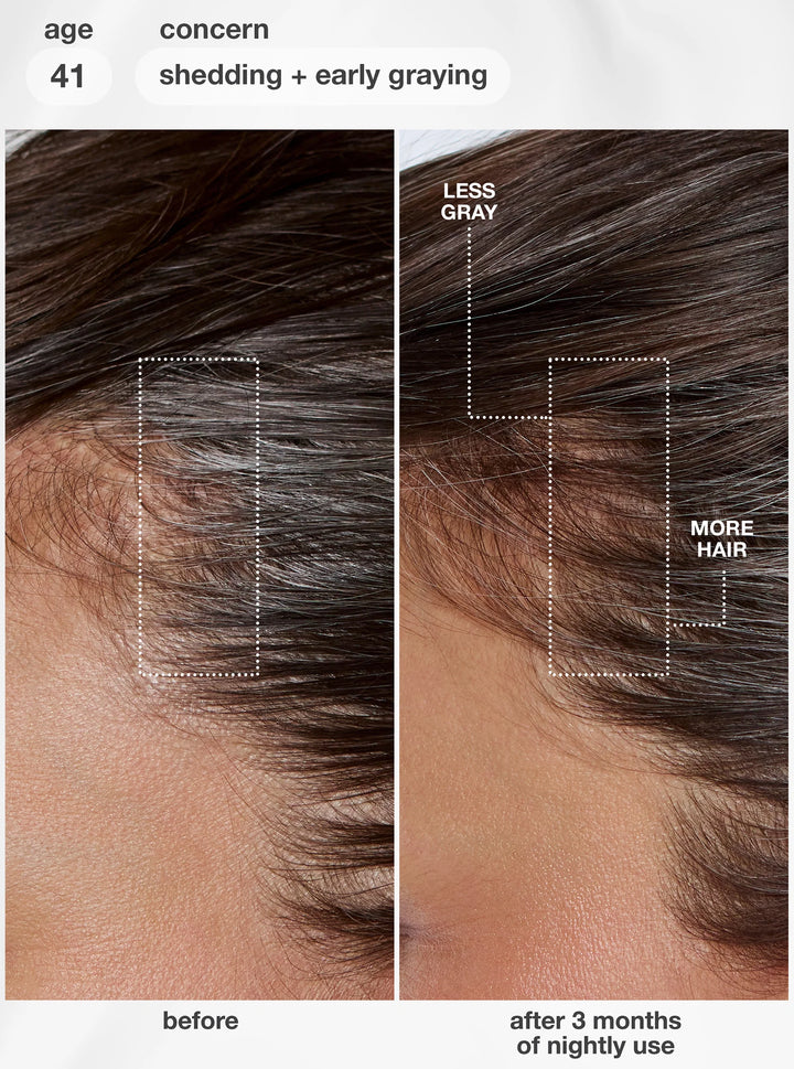 K18 FutureIQ Biomimetic Hair Longevity Serum | Reduce Shedding, Graying + Scalp Aging