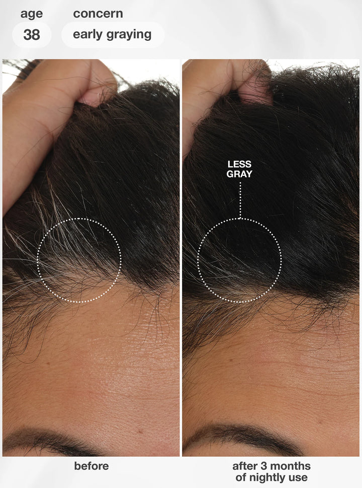 K18 FutureIQ Biomimetic Hair Longevity Serum | Reduce Shedding, Graying + Scalp Aging