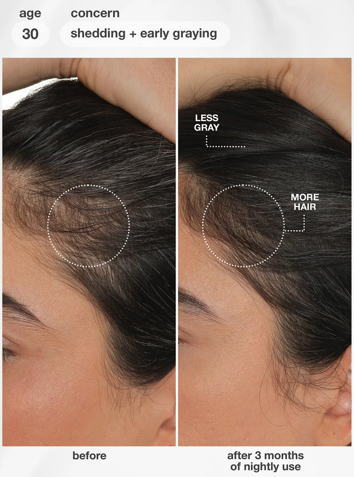 K18 FutureIQ Biomimetic Hair Longevity Serum | Reduce Shedding, Graying + Scalp Aging
